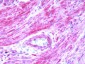 BDKRB2/Bradykinin B2 Receptor Antibody (C-Terminus)